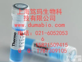 Rabbit Anti-Human <em>IgM</em>*<em>HRP</em>     <em>HRP</em>*兔抗人<em>IgM</em>