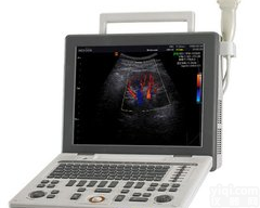 <em>麦迪逊</em> SonoAce R3便携式<em>彩超</em>