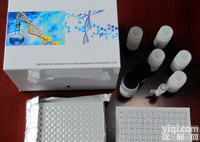 裸鼠<em>甲胎蛋白</em>(AFP)ELISA<em>试剂盒</em>,进口<em>甲胎蛋白</em>