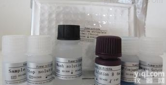 人抗异<em>亮氨酸</em>氨酰<em>tRNA</em>连接酶,细胞质(IARS)<em>抗体</em>elisa测定试剂盒