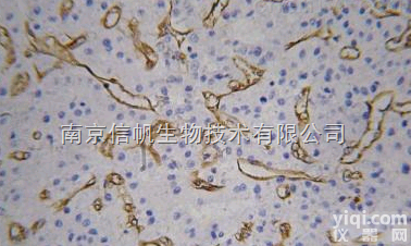 免疫组化<em>技术服务</em>，免疫组化<em>实验</em>代测