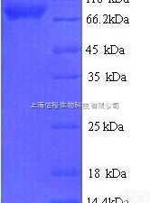 <em>苹果酸</em>，分析<em>标准品</em>,HPLC≥98%