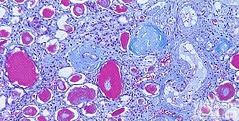 COL1α1 elisa<em>试剂盒</em>,人Ⅰ型<em>胶原</em>α1<em>检测</em><em>试剂盒</em>