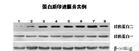 DBP elisa试剂盒,人DNA结合蛋白检测试剂盒