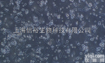 人微血管内皮<em>细胞</em>株,<em>HMEC</em>-1<em>细胞</em>