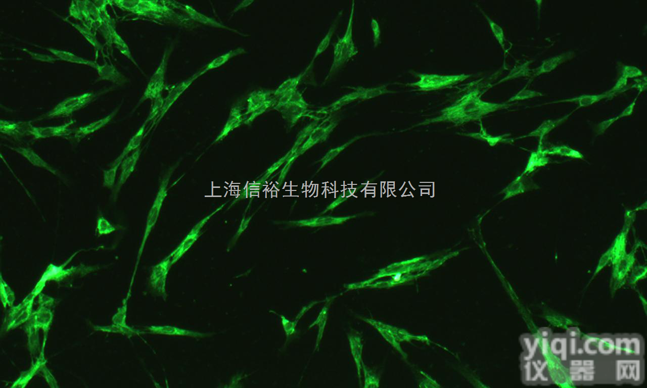 HCCC-9810<em>细胞</em>,人<em>胆管</em><em>细胞</em>型<em>肝癌</em><em>细胞</em>