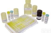 <em>Lipofectamine</em>® 3000 <em>Transfection</em> <em>Reagent</em>（L3000015）