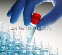 (2S,3S)-(+)-2,3-双(<em>二苯基膦</em>基)<em>双环</em>[2.2.1]庚-5-烯，98%