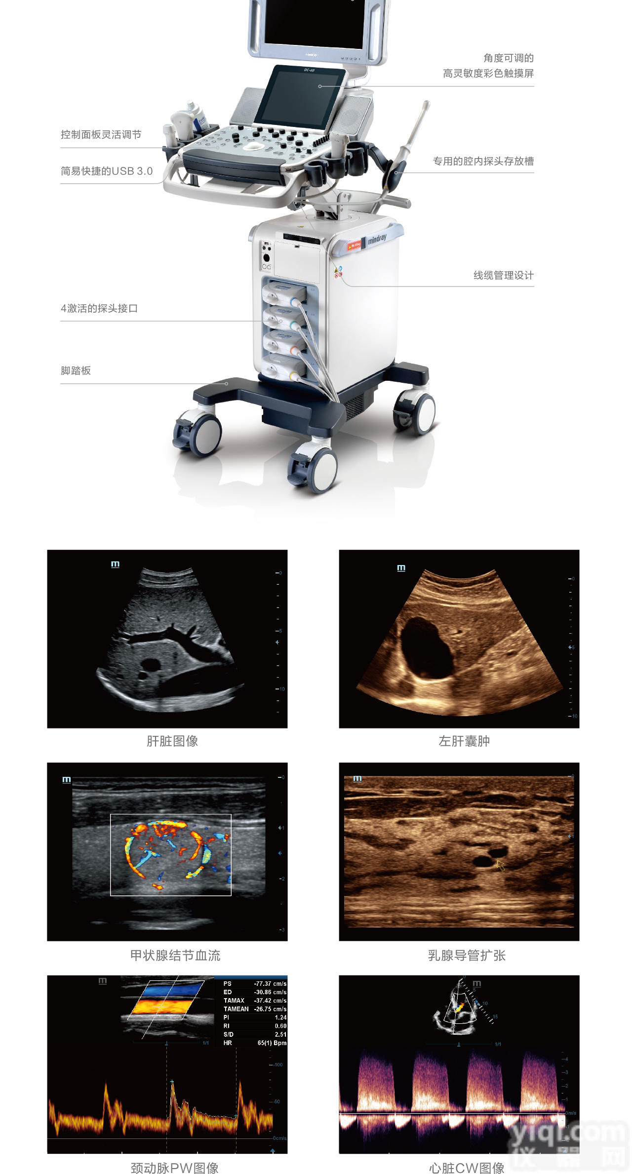 迈瑞中高端四维<em>彩超</em>机，<em>全身</em><em>彩超</em>设备供应商