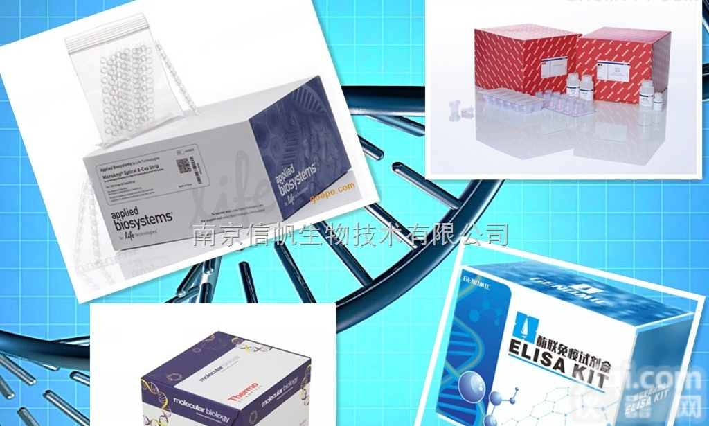 <em>小鼠</em>甲种胎儿<em>球蛋白</em>/<em>甲胎蛋白</em> elisa试剂盒，甲种胎儿<em>球蛋白</em>/<em>甲胎蛋白</em>检测