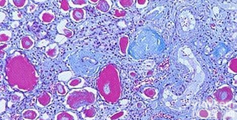 <em>小鼠</em><em>白三烯</em>B4 elisa<em>试剂盒</em>，<em>白三烯</em>B4检测