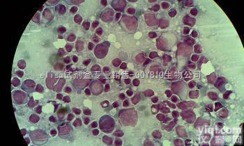 人肝<em>腹水</em>腺<em>癌细胞</em>；SK-HEP-1<em>价格</em>