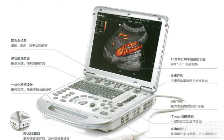 迈瑞<em>便携式</em><em>四维</em><em>彩超</em>机M7T民营医院高端<em>便携式</em><em>彩超</em>
