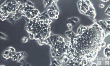 SW1783<em>人脑</em><em>星形</em><em>胶质瘤</em>细胞