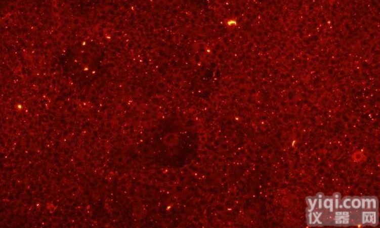 小鼠<em>冠状</em><em>微血管</em><em>内皮</em>细胞