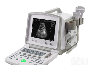 便携式b超 手提式黑白B超 <em>全数字超声诊断仪</em>