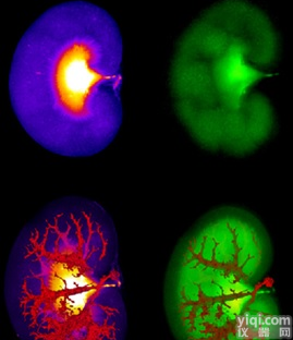 XERRA<em>荧光</em>断层<em>扫描成像</em>