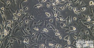 A-<em>204</em> 人<em>横纹肌</em><em>肉瘤</em>细胞