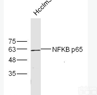 内皮糖<em>蛋白</em>抗体<em>CD105</em>