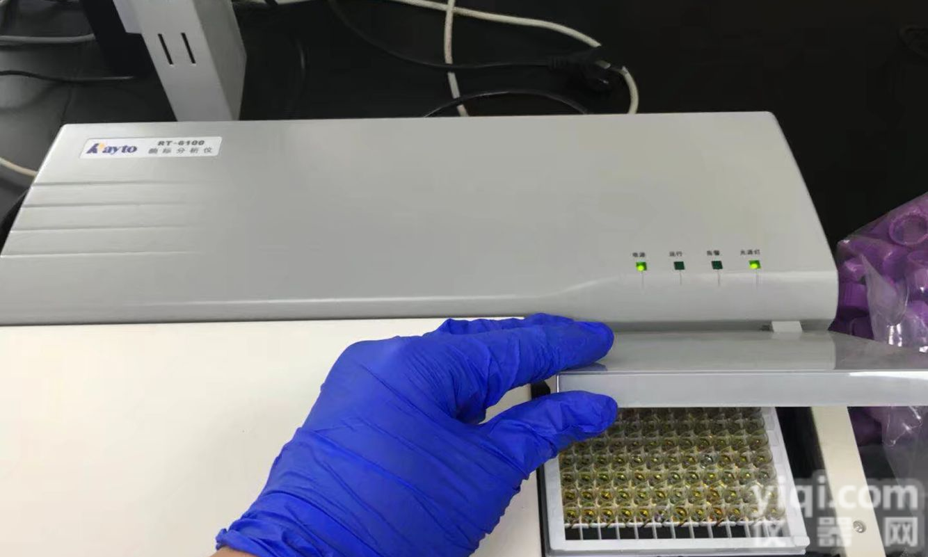 血清总铁结合能力<em>试剂盒</em> 微量法 语纯<em>快讯</em>