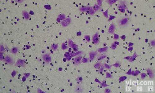 Transwell细胞迁移实验<em>技术服务</em>外包代做上海