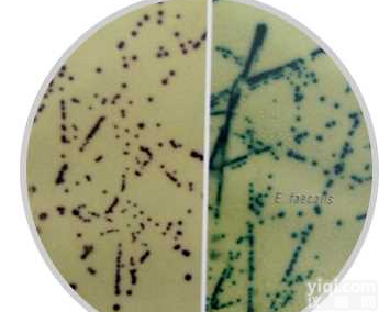 <em>显色</em><em>培养基</em>B族<em>链球菌</em>（第二代）