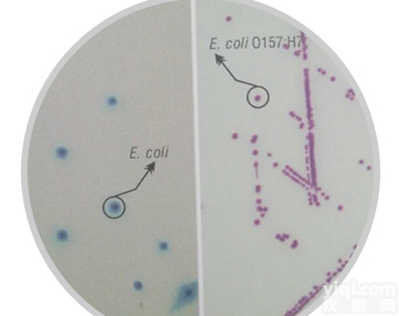 显色<em>培养基</em>大肠杆菌O157<em>选择性</em>（国标）