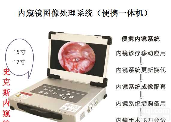 史克斯<em>内窥镜</em>便携式摄像系统/气腹机/冲洗灌注泵/吸引<em>切割器</em>/子宫切除器