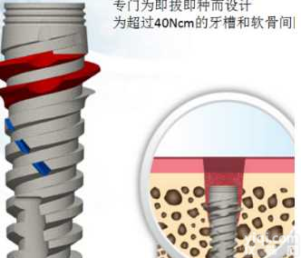<em>种植</em>体<em>系统</em> CORTEX