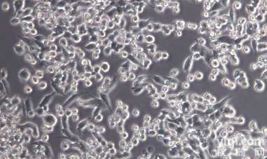 TPC-1人<em>甲状腺</em>乳头状<em>癌细胞</em>株