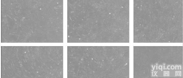 B16-F10--RED<em>小鼠</em>皮肤<em>黑色素瘤</em>细胞-红色<em>标记</em>