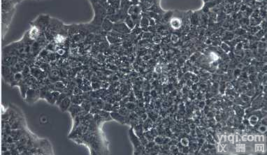 肺癌LTEP-P（<em>圆形</em>）小<em>细胞</em>