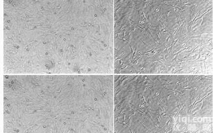 <em>小鼠</em>肺<em>大静脉</em><em>平滑肌</em>原代细胞