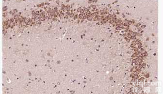 <em>小鼠</em><em>导管</em><em>上皮</em>细胞