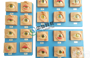 <em>常见眼病模型 眼睛疾病症状模型</em>
