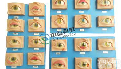 常见眼病<em>模型</em> 眼睛<em>疾病</em>症状<em>模型</em>