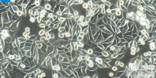 人<em>结肠</em>腺<em>癌细胞</em>/STR<em>鉴定</em>/赛百慷（iCell）