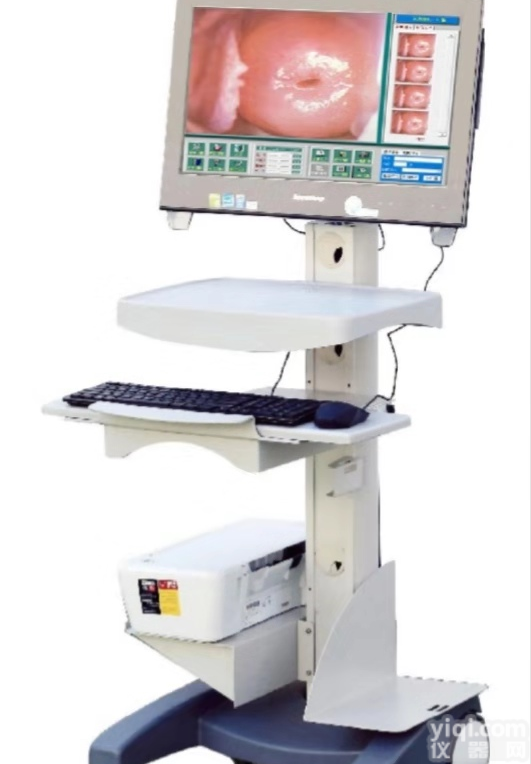 <em>阴道</em>镜多少钱高清<em>阴道</em>镜厂家直销<em>阴道</em>镜生产厂家数码<em>电子</em><em>阴道</em>镜