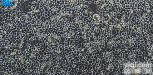 人导管<em>腺癌</em>细胞/STR<em>鉴定</em>/赛百慷（iCell）