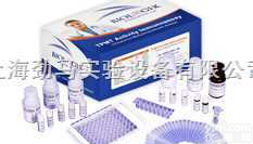 人ELISA<em>试剂盒</em>,血管<em>内皮</em>细胞生长<em>因子</em>受体3 ELISA<em>试剂盒</em>