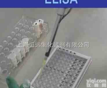 小鼠抗α-胞衬蛋白<em>抗体</em>IgG/<em>IgA</em><em>试剂盒</em>