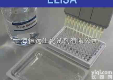 人可溶性<em>腺苷酸</em>环化酶<em>试剂盒</em>