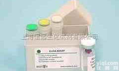 人抗<em>脱氧</em>核糖<em>核蛋白</em>抗体<em>试剂盒</em>