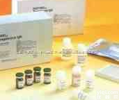 人丝?血球<em>凝集</em>素Elisa<em>试剂盒</em>,（FHA）Elisa<em>试剂盒</em>报价|<em>说明书</em>