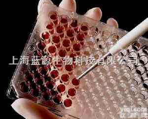 Anti-<em>MTHFR</em>,<em>亚甲基</em>四氢<em>叶酸</em>还原酶<em>MTHFR</em><em>抗体</em>