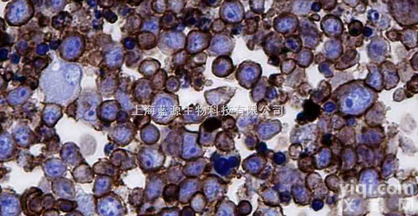 NCI-H292<em>肺癌</em><em>细胞</em><em>淋巴结</em>转移