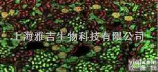 小鼠<em>海马</em>趾<em>星形</em><em>胶质</em>细胞