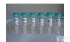 兔抗人丝氨酸/<em>苏氨酸</em>激酶(C-<em>末端</em>)单克隆抗体,DARPP-32 (C-term)