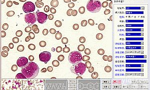 外周血<em>细胞</em><em>形态学</em>软件 （血<em>细胞</em>）
