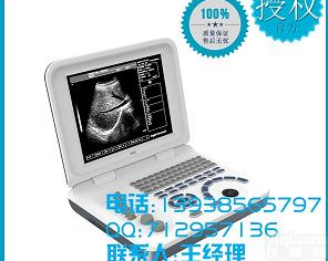 便携式b超机笔记本式<em>便于</em><em>携带</em>